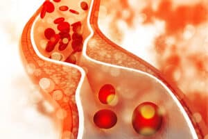 Giảm lượng cholesterol trong máu.